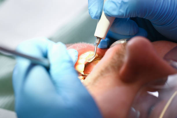 Best Urgent Tooth Repair  in San Miguel, CA